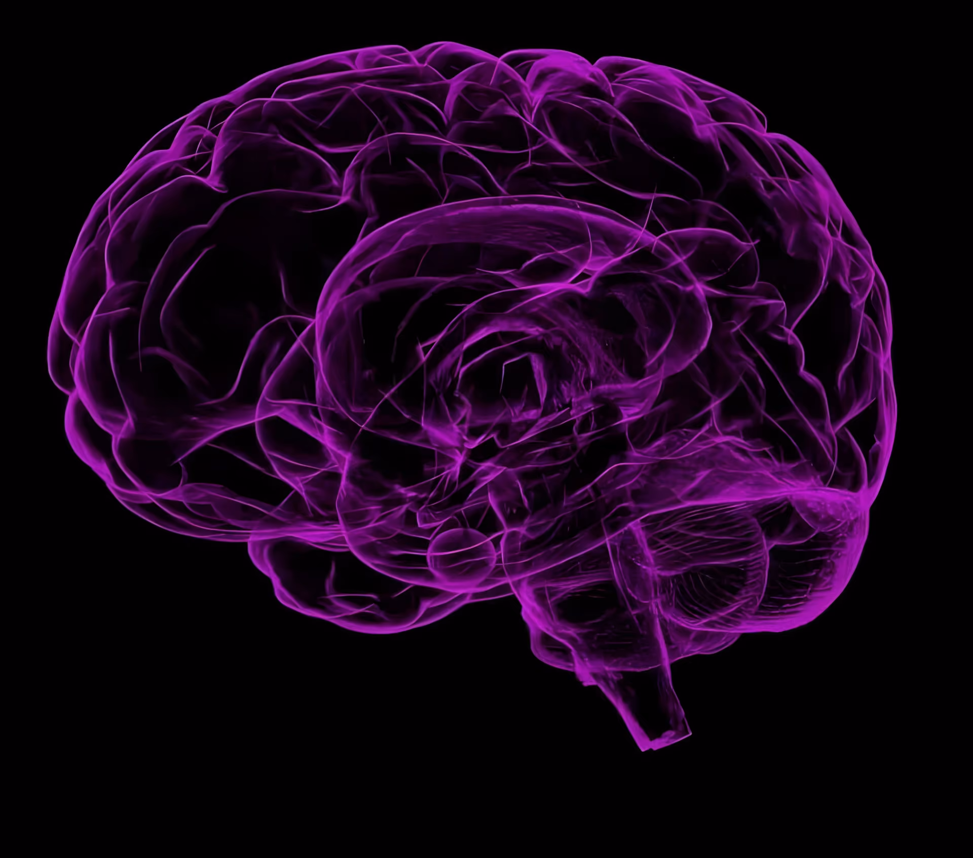 Vascular Dementia: Symptoms, Causes, Treatments & More